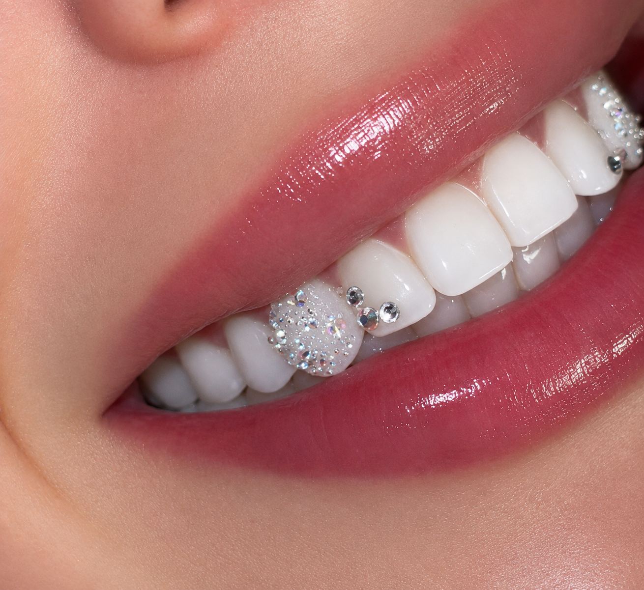 Whitening and tooth gem work at Medusa Studio
