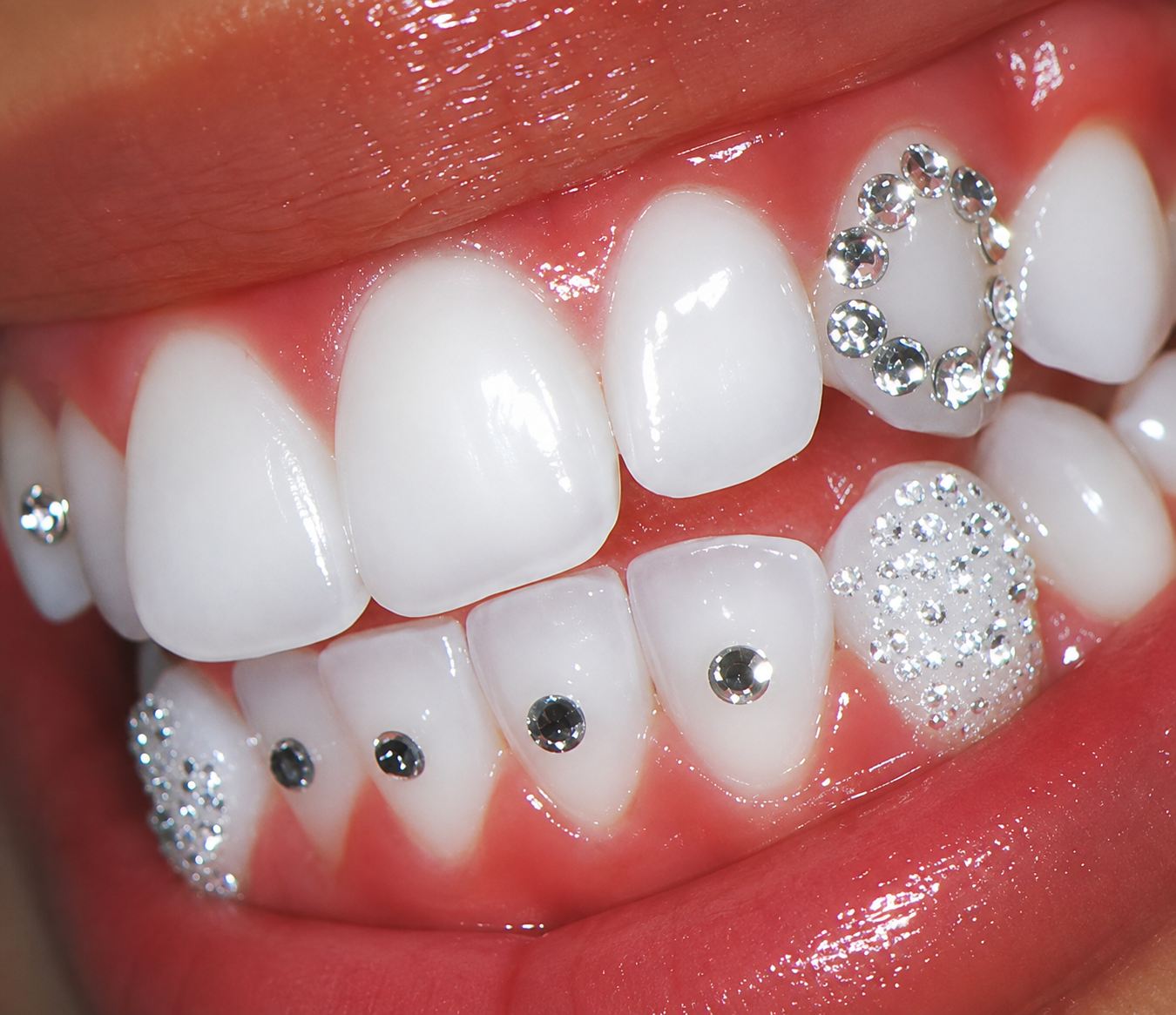 Whitening and tooth gem work at Medusa Studio