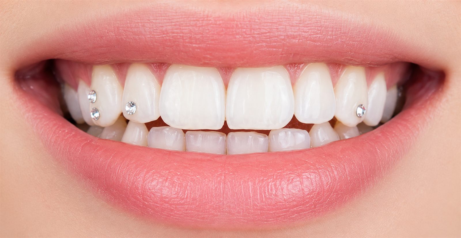Hand-placed tooth gems at Medusa Studio
